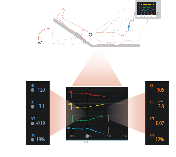 Mostcare perioperatorio Mostcare perioperatorio