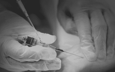 ¿Por qué se amortigua la señal de un catéter arterial?