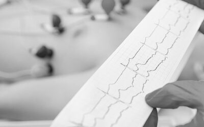 Colocación de PICC en pacientes con fibrilación auricular