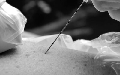 Dr. Sergio Fuertes: «la ecografía ha marcado una ruptura en el trabajo de los especialistas en rehabilitación intervencionista»