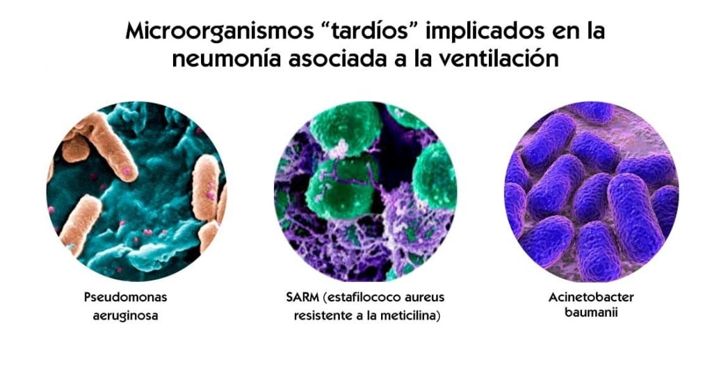 neumonía asociada a la ventilación