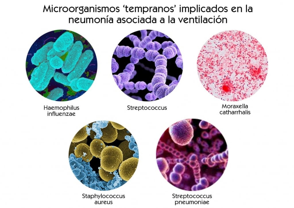 neumonía asociada a la ventilación