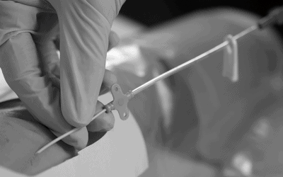 El catéter de línea media o Midline ¿Qué es?