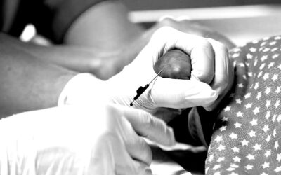 ¿Por qué elegir la venopunción en prematuro?