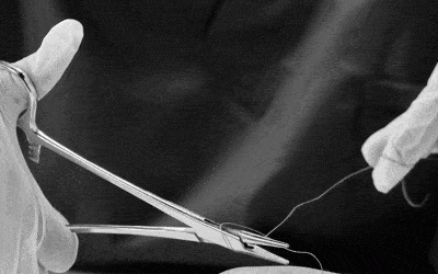 Comparativa sistemas de fijación de catéteres venosos