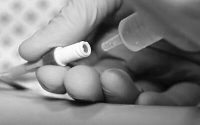 Sistemas de acceso venoso. Recomendaciones de las guías.