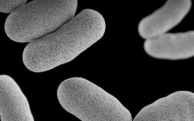 ¿Cuándo tengo que retirar un PICC si creo que se ha infectado?