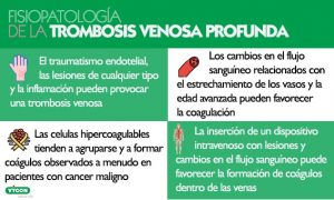 fisiopatología de la trombosis
