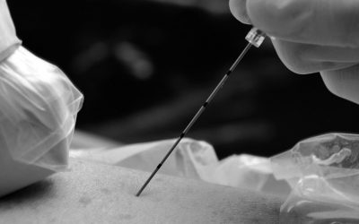 Guías para la anestesia regional en tiempos de COVID-19 según ESRA y ASRA