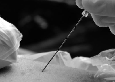 Whitepaper: Guías para la anestesia regional en tiempos de COVID-19 según ESRA y ASRA