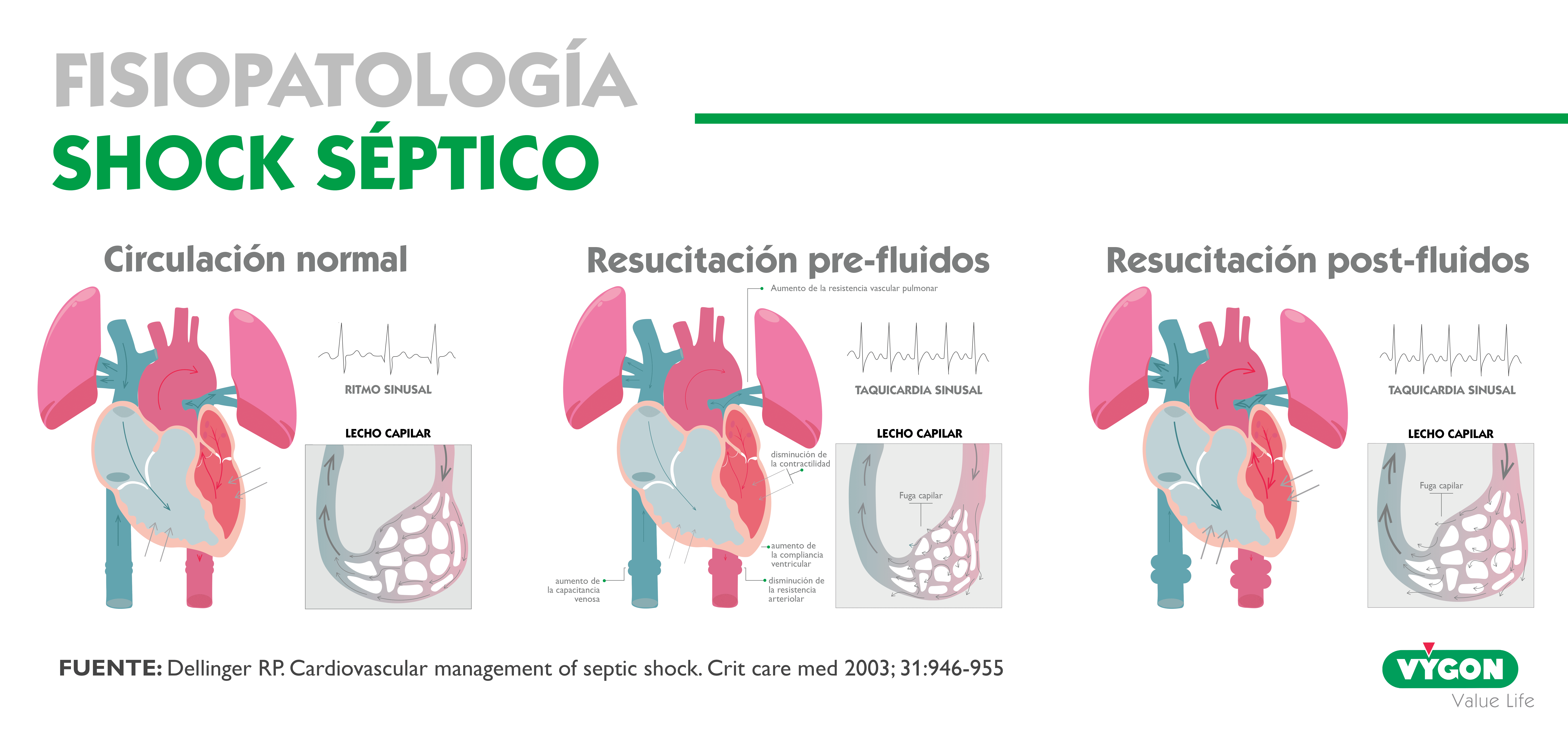 fisiopatología shock séptico