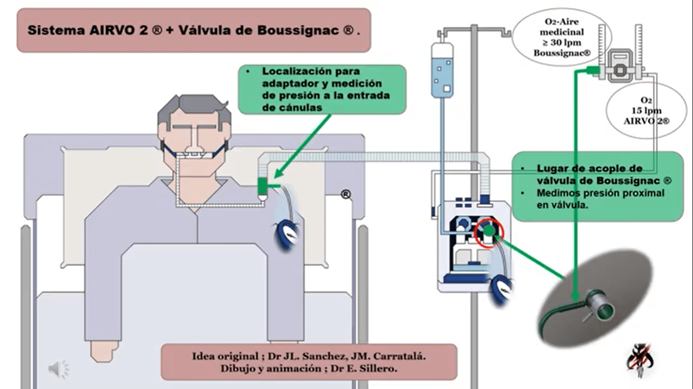 cpap y alto flujo