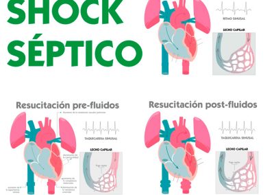 Fisiopatología shock séptico