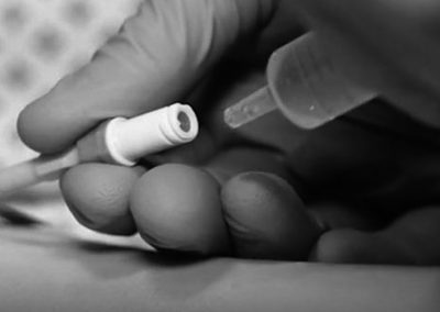 Whitepaper: Sistemas de acceso venoso. Recomendaciones de las guías.