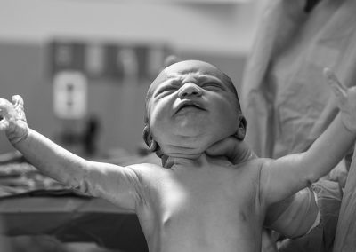 Whitepaper: La revolución de la neonatología