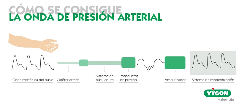 onda presión arterial