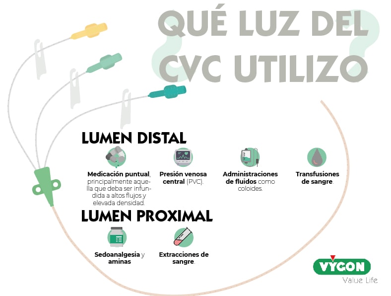 qué luz del cvc utilizar
