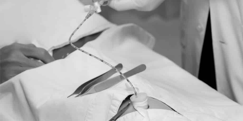 Materiales catéteres umbilicales