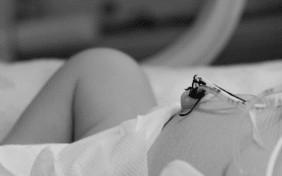 ¿Cómo colocar un catéter umbilical?: Protocolo de inserción y fijación