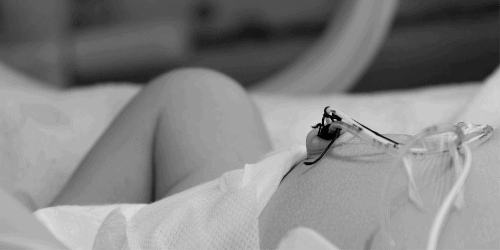 ¿Cuándo está indicado el uso de un catéter umbilical?