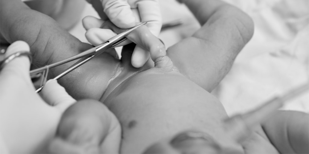 ¿Cuándo está indicado el uso de un catéter umbilical?