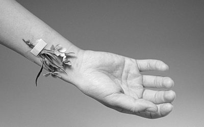 Complicaciones cutáneas en el acceso vascular: las MARSI