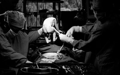 ¿Cuándo está indicado el uso de un catéter umbilical?