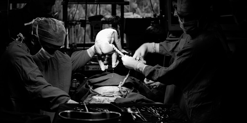 ¿Cuándo está indicado el uso de un catéter umbilical?