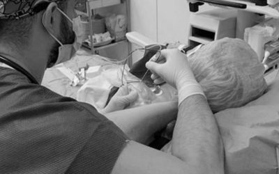 Claves para realizar un buen bloqueo del plexo braquial a nivel axilar