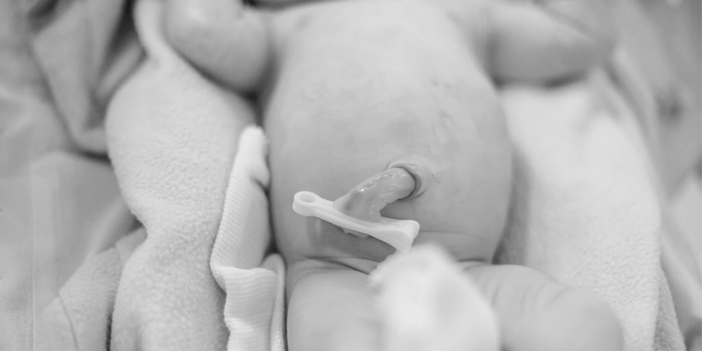 ¿Cuándo está indicado el uso de un catéter umbilical?