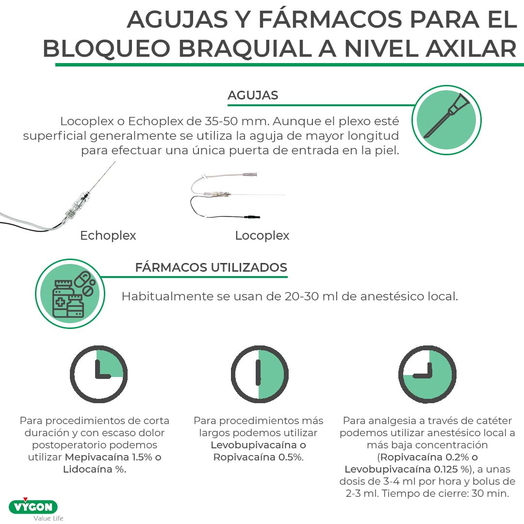 Claves para realizar un buen bloqueo del plexo braquial a nivel axilar