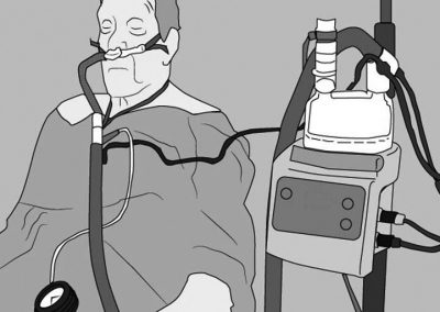 Whitepaper: CPAP vs Alto Flujo: ¿por qué elegir si las puedes combinar con mejores resultados?