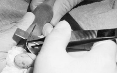 ¿Cómo insertar un PICC en neonatos?: Protocolo de colocación, mantenimiento y retirada