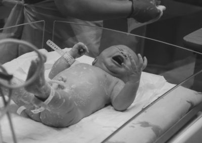 Whitepaper: PICC neonatales, rotura, extravasación y obstrucción del PICC. ¿Cómo actuar?