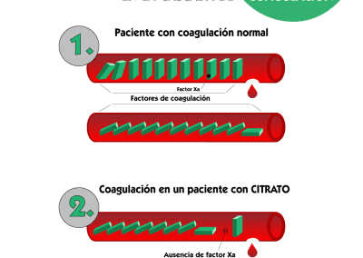 Efecto del citrato en la cascada de coagulación