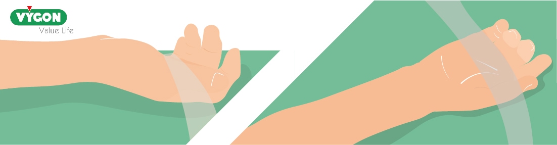 colocación brazo para catéter arterial