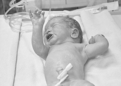 Whitepaper: Cuidado del cordón umbilical