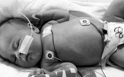 ¿Qué catéter elegir como acceso venoso en neonatos?