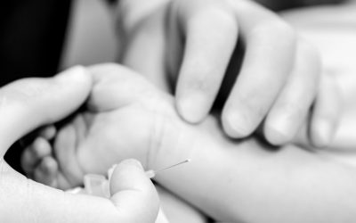 Canalización arterial ecoguiada en 6 pasos