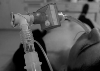 Whitepaper: Intubación segura en tiempos de COVID-19, el papel de las bujías