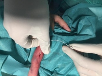 Línea media neonatos 3