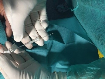 Línea media neonatos 4