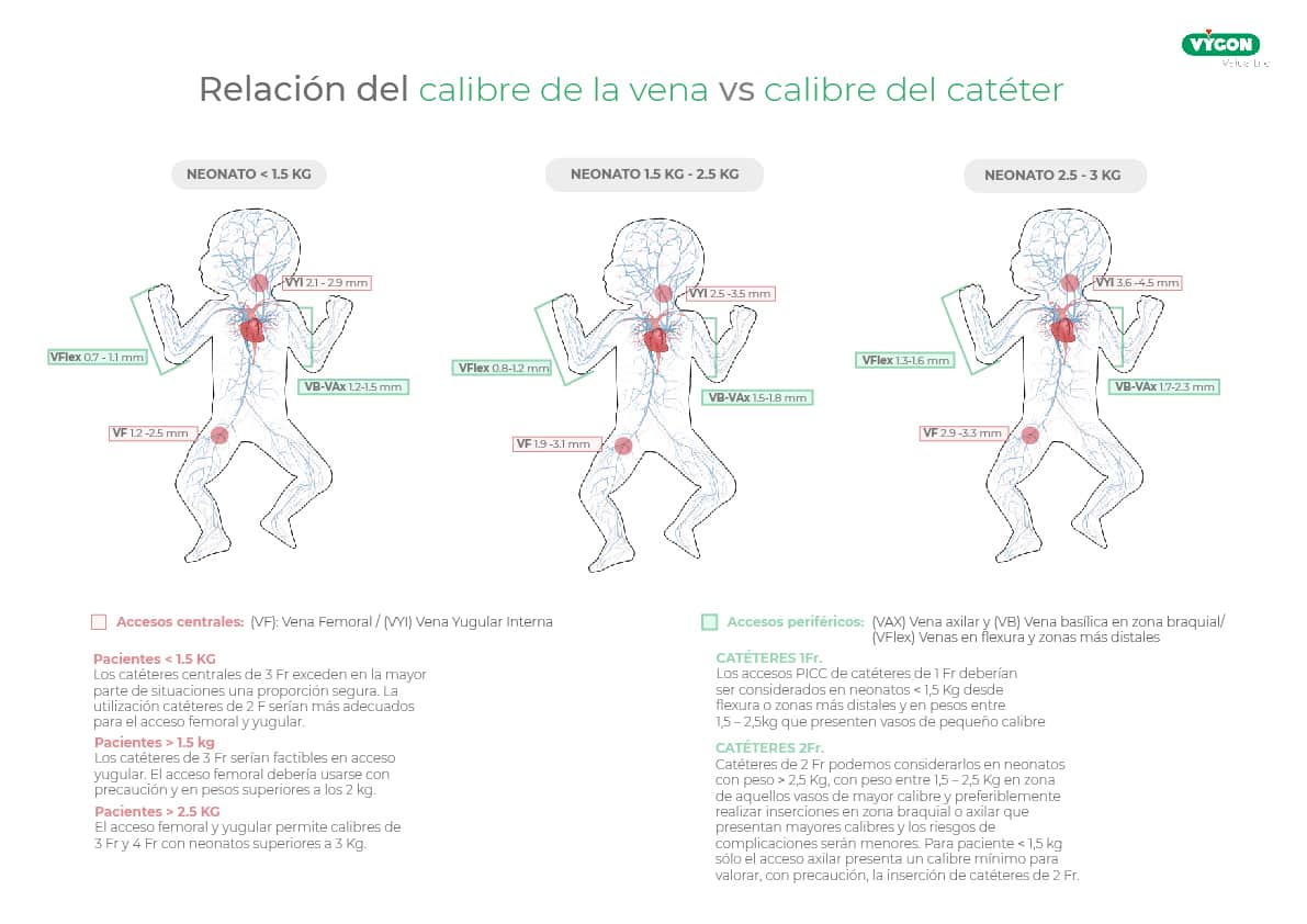 Relación del calibre de la vena vs calibre del cateter
