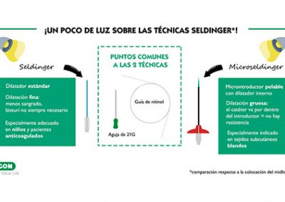 Ventajas de la Seldinger clásica y de la Microseldinger