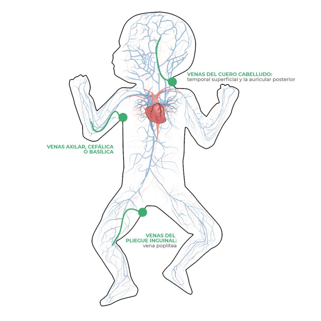 posición línea media