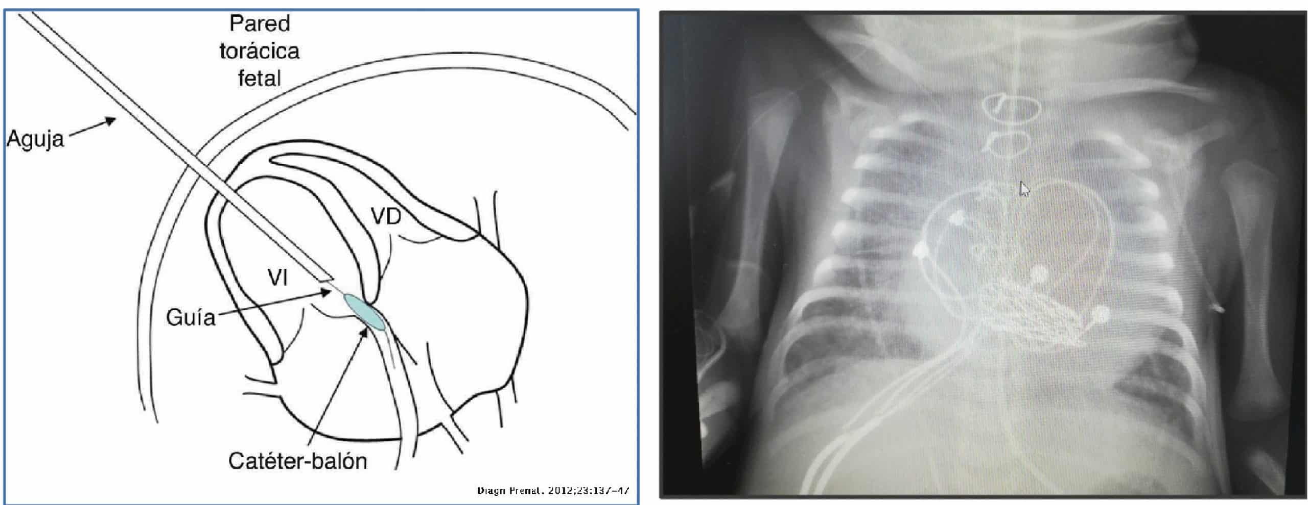 postoperatorio cx cardiaca