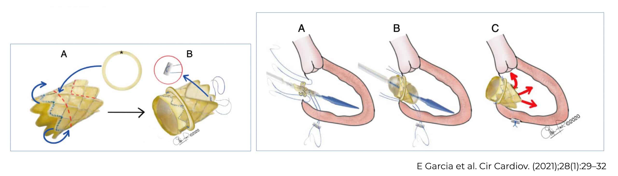 postoperatorio cx cardiaca ped
