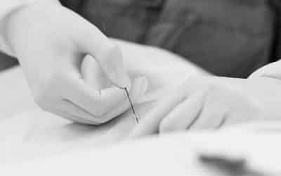 Características y recomendaciones para los accesos venosos centrales más utilizados