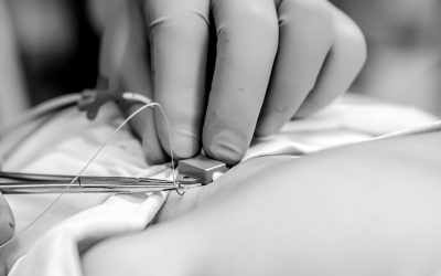 3 Claves para la elección de la vía central a canalizar en pediatría