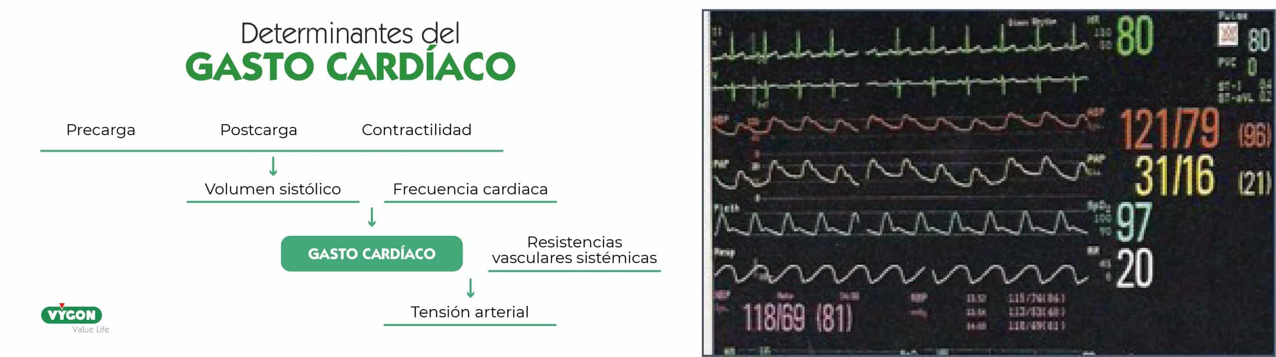 determinantes del gc